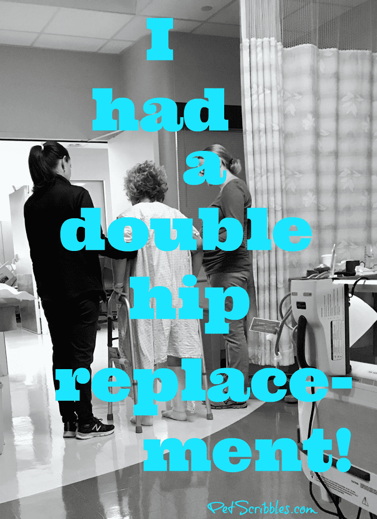 I had a double hip replacement
